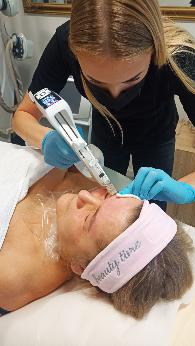 Mezoterapia wieloigłowa próżniowa Vitten Injector - obrazek 2