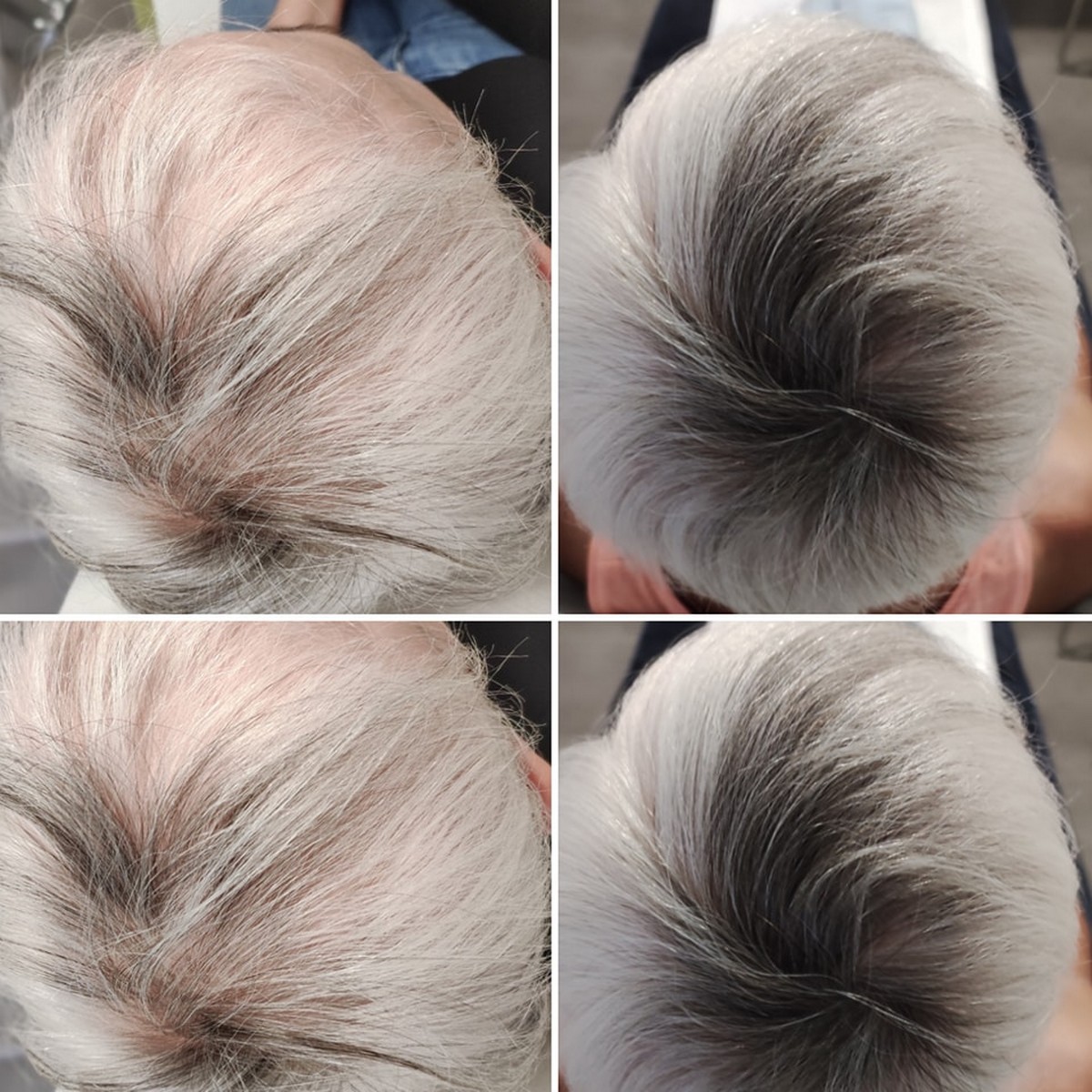 BLACK FRIDAY 3+1 GRATIS!!! ResurHair - Laserowa Stymulacja Wzrostu Włosów - obrazek 12